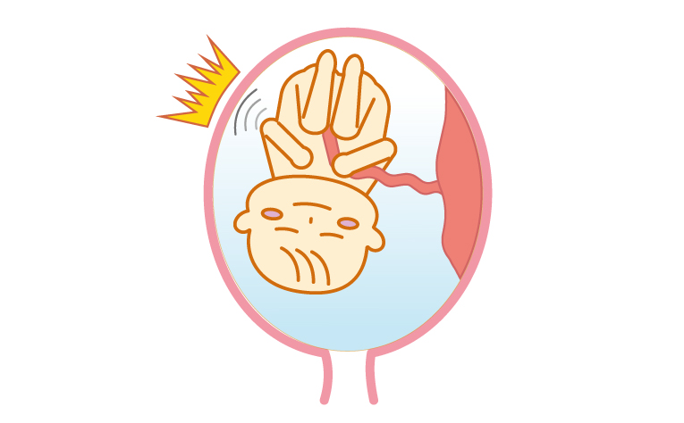 羊水の役割、衝撃の緩和