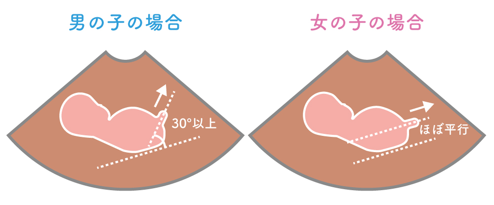 ベビーナブの男女の見分け方